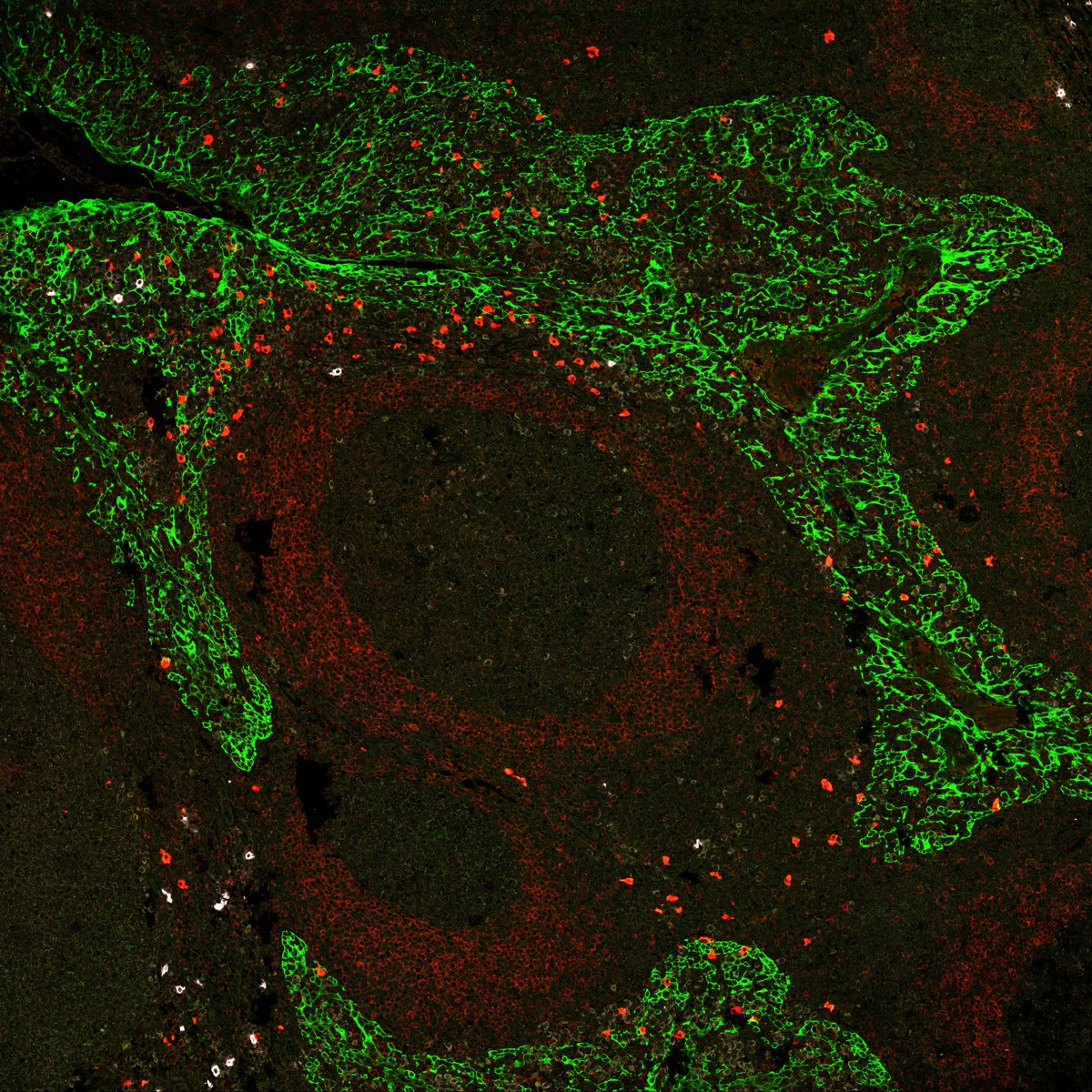 I usually spend hours in #FluorescenceFriday , here my little contribution.
Tile scan in a 🔬LSM 980 @ZEISS_Group  
#GerminalCenter #IgD #BCells
#FluorescenceFriday