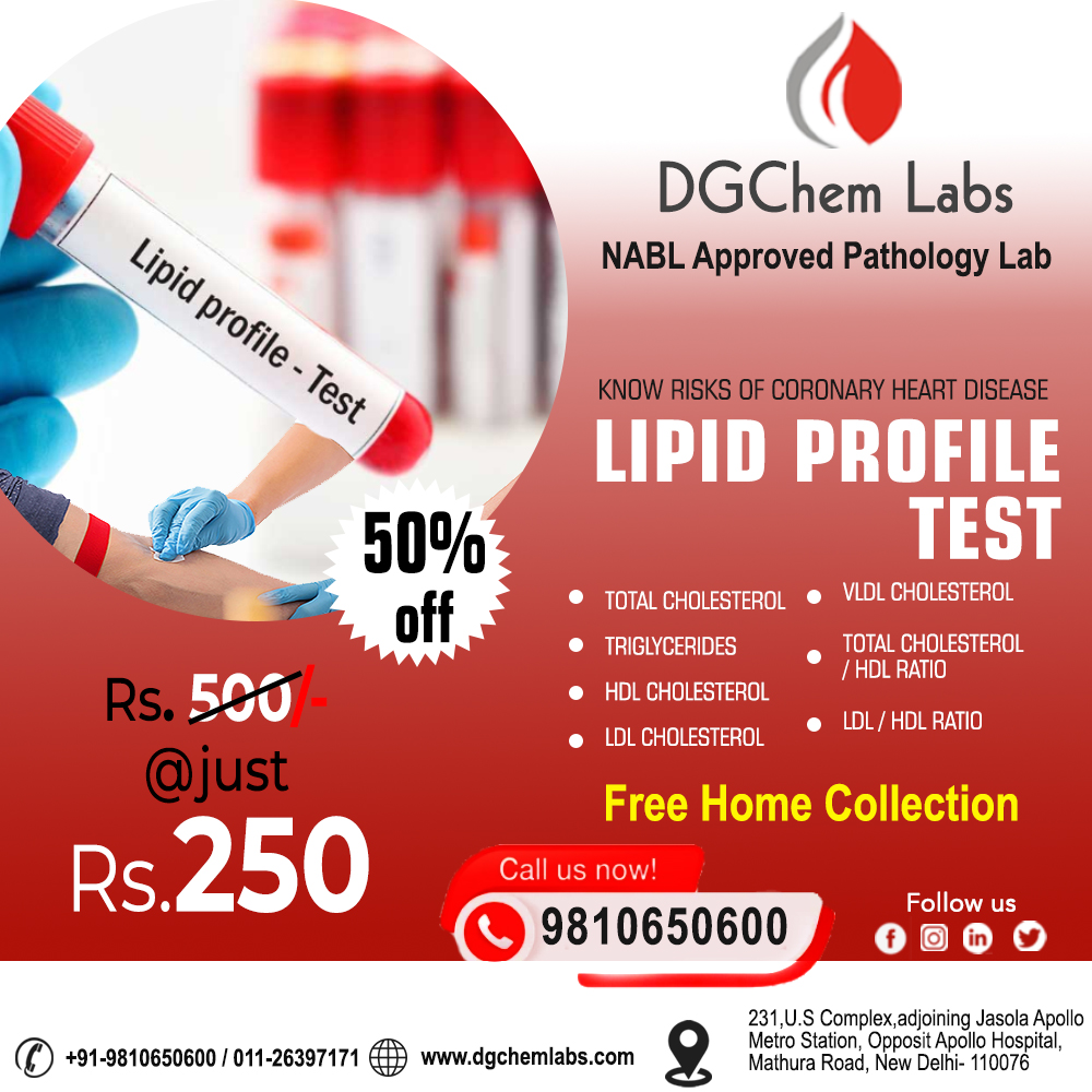 DgchemLabs's tweet photo. Book Lipid Profile Test in Delhi NCR at DGChem Labs ( NABL Approved Lab). Free Home Sample Collection. Online Reports. Flat 50% Off. Book Now!

#LipidProfileTest   #LipidProfileTestDelhi, #LipidProfileTestDelhiNCR, #LipidProfileTestPrice
 #LipidProfileCostDelhi  #LipidPanelTest https://t.co/XQyIhoLlzJ