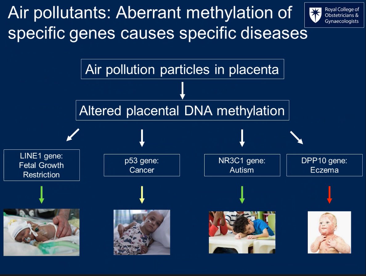 globalhlthtwit's tweet photo. And how air pollution affects the expression of genes that may contribute to diseases in childhood (7) https://t.co/rXKoESOKQ5