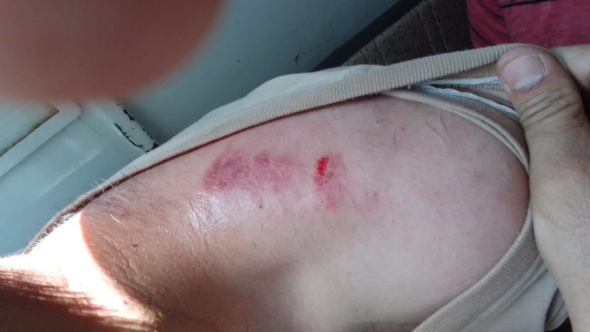 sandeepdhar10's tweet photo. This is how poor Kashmiri Pandit Govt employees were tear-gassed and lathicharged in #Budgam earlier today. Is this what Kashmiri Pandits deserve for unfurling Indian tricolour and worshiping our Mother India in Kashmir? Shocking silence by the Government. https://t.co/UGimBZzzKk