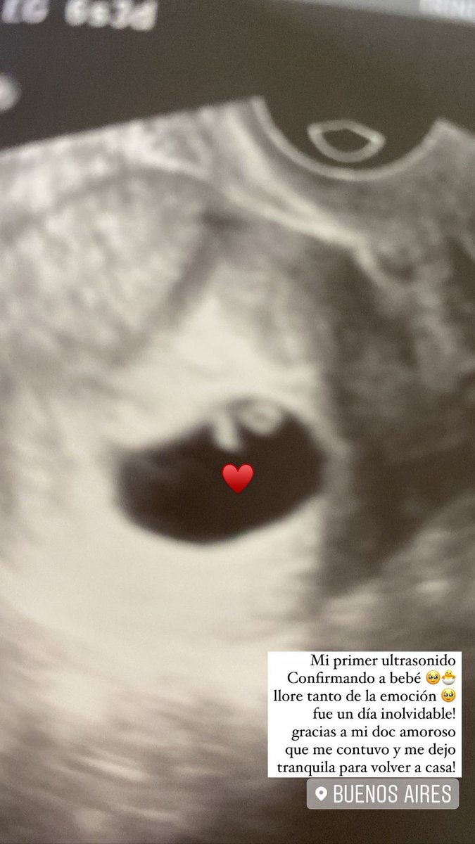 Valeria Baroni News tweet media