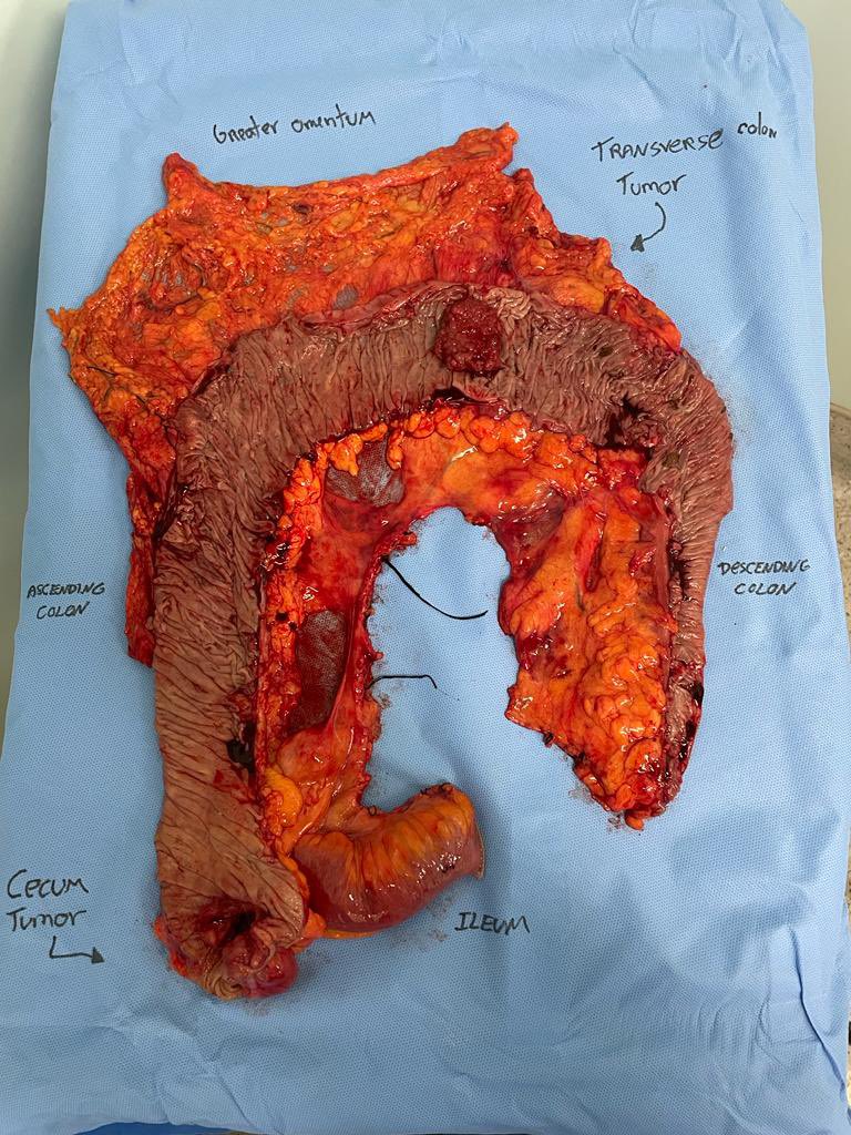 Rodrigo Gomes da Silva MD, PhD tweet media