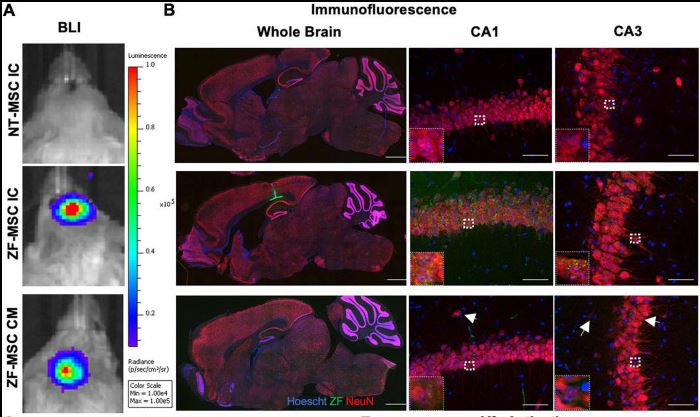 MMPCatUCDavis's tweet photo. Hong et al. used #MSCs to secrete #zincfinger proteins in #mice and macaques! They also activated #Ube3a in a #TransgenicMouse and reduced motor deficits in an #AngelmanSyndrome mouse! @UCDavis @UCDavisResearch @PhDeng_ @jan_nolta @lab_segal
https://t.co/MzSsETJox4 https://t.co/u0kr312JPU