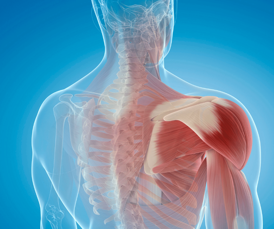 Patients can get stiffness from prolonged limited use of the arm. If it does not improve with physical therapy and injections, surgery is often the only way to correct it, followed with aggressive physical therapy after surgery. 
 loyolamedicine.org/provider/nicko… 
#arthroscopy