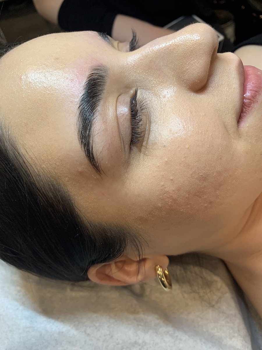 GBofbeauty's tweet image. First brow lamination in the books. Swipe to see the results 🥰. 

#brows #browlamination #firsttime #esthetician #student #obssesed #browshaping #ilovebrows #esthetics #esthicianstudent #metrodetroit #makeupartist