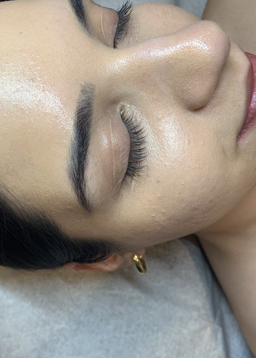 GBofbeauty's tweet image. First brow lamination in the books. Swipe to see the results 🥰. 

#brows #browlamination #firsttime #esthetician #student #obssesed #browshaping #ilovebrows #esthetics #esthicianstudent #metrodetroit #makeupartist