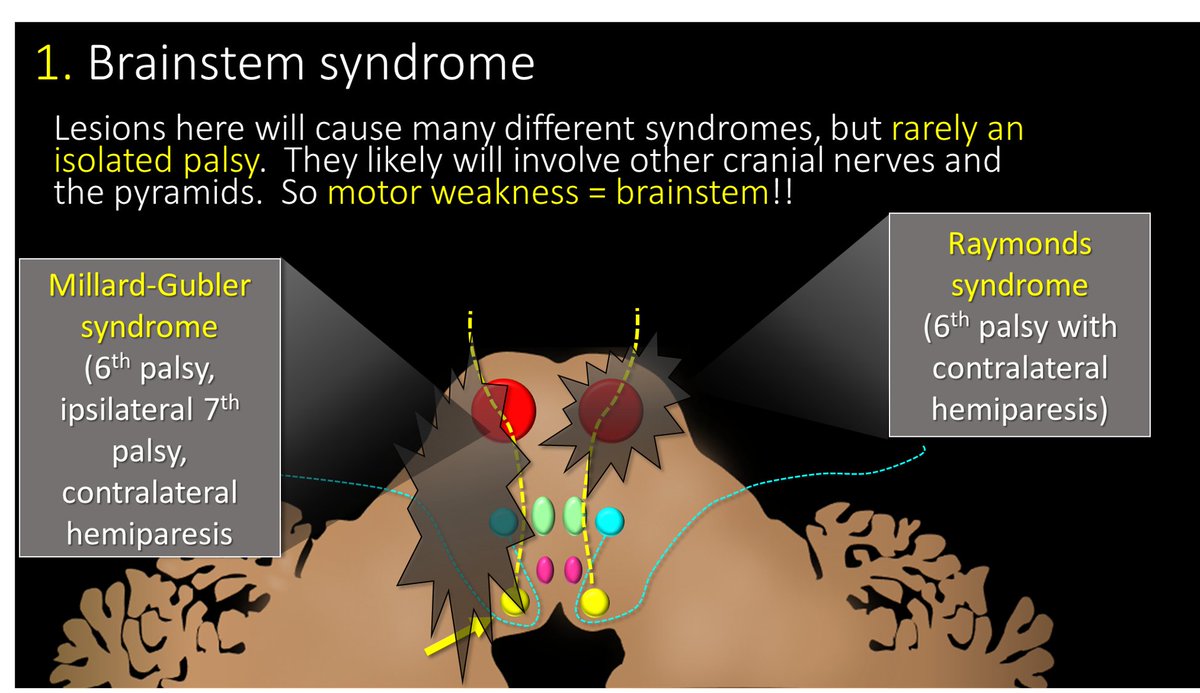 12/Compressive, ischemic or inflammatory lesions may affect CN6 here, but likely other CNs & pyramids will be affected. There are specific syndromes, but key point--if there are other deficits, especially MOTOR, a deficit unique to brainstem lesions—it’s time to call neurology!