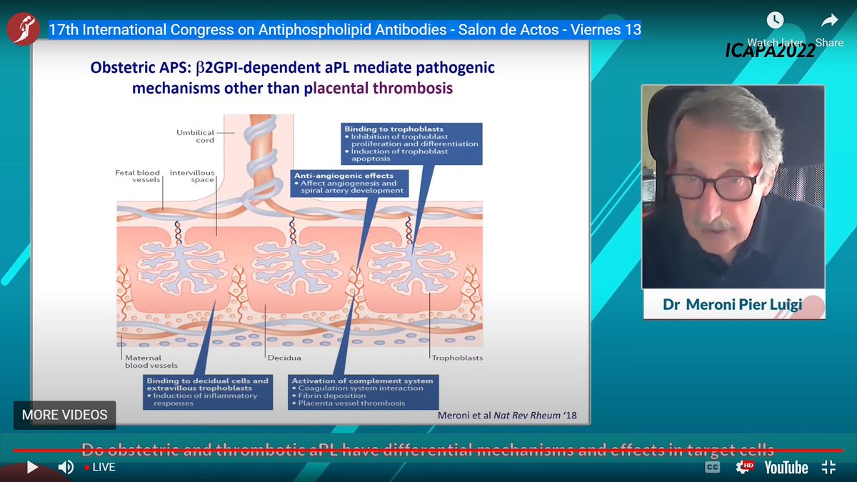 jasonsknight's tweet image. Brilliant talk by the #APS 🐐 (IMHO) about why the placenta is particularly susceptible to anti-B2GPI antibodies #ICAPA2022 🇦🇷