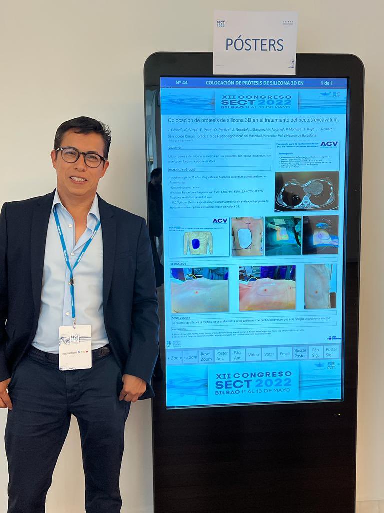 Colocación de prótesis de silicona 3D en el tratamiento del pectus excavatum.
 @SECT toracica #BilboONSECT2022 #BilboSECT2022  <a href="/ThoracicSurgHVH/">Cirugía Torácica. Hospital Vall d’Hebron</a>