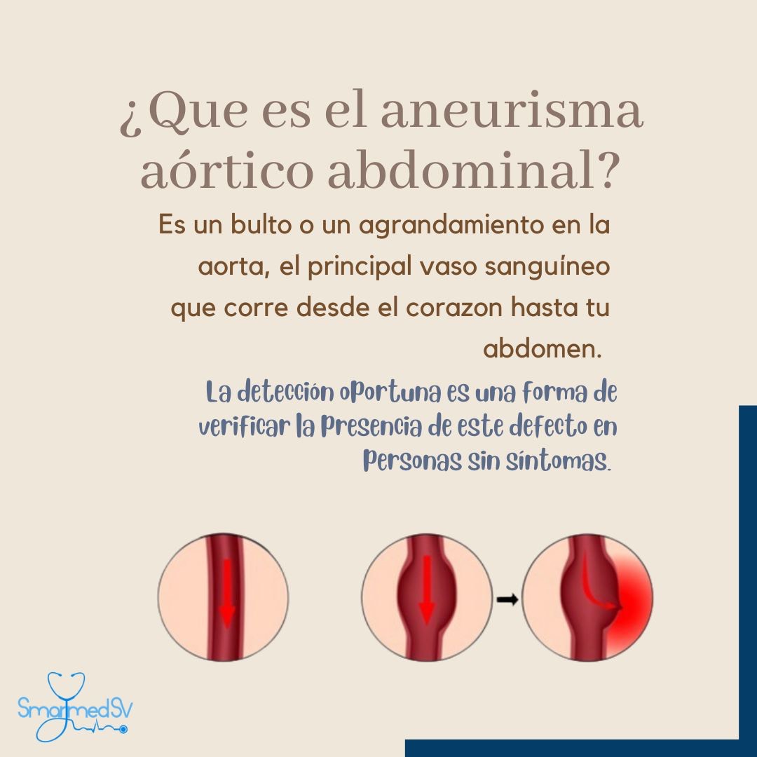 SmartMed_sv's tweet photo. Detección oportuna de aneurisma aórtico abdominal.
#smarttalksv
@SmartMed_sv
Autor: @ZulmaSosa95 https://t.co/oKUoSzo17O