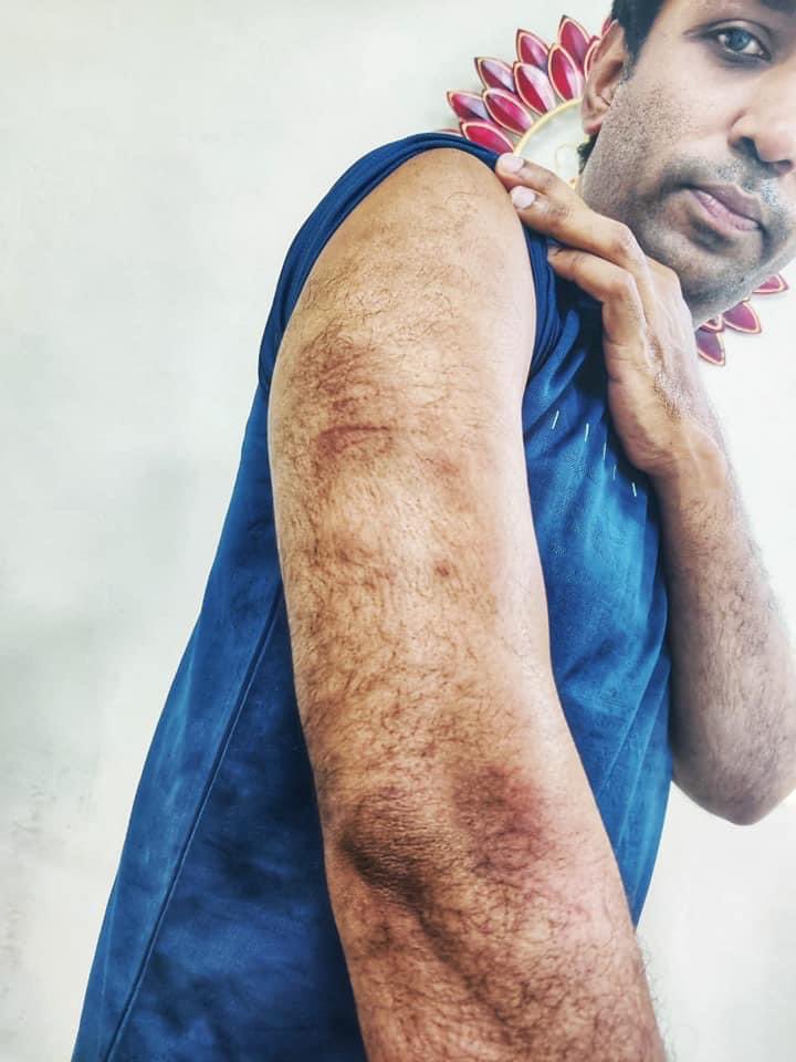 VikrantBhuria's tweet image. वाटर कैनन का ये कैसा दुरुपयोग ? 

रोज़गार की माँग करने वाले युवाओं के साथ अपराधियों जैसा सलूक। वाटर कैनन के तेज प्रेशर से छिड़काव जानलेवा हो सकता था। 

सत्ता का ये कैसा अहंकार !