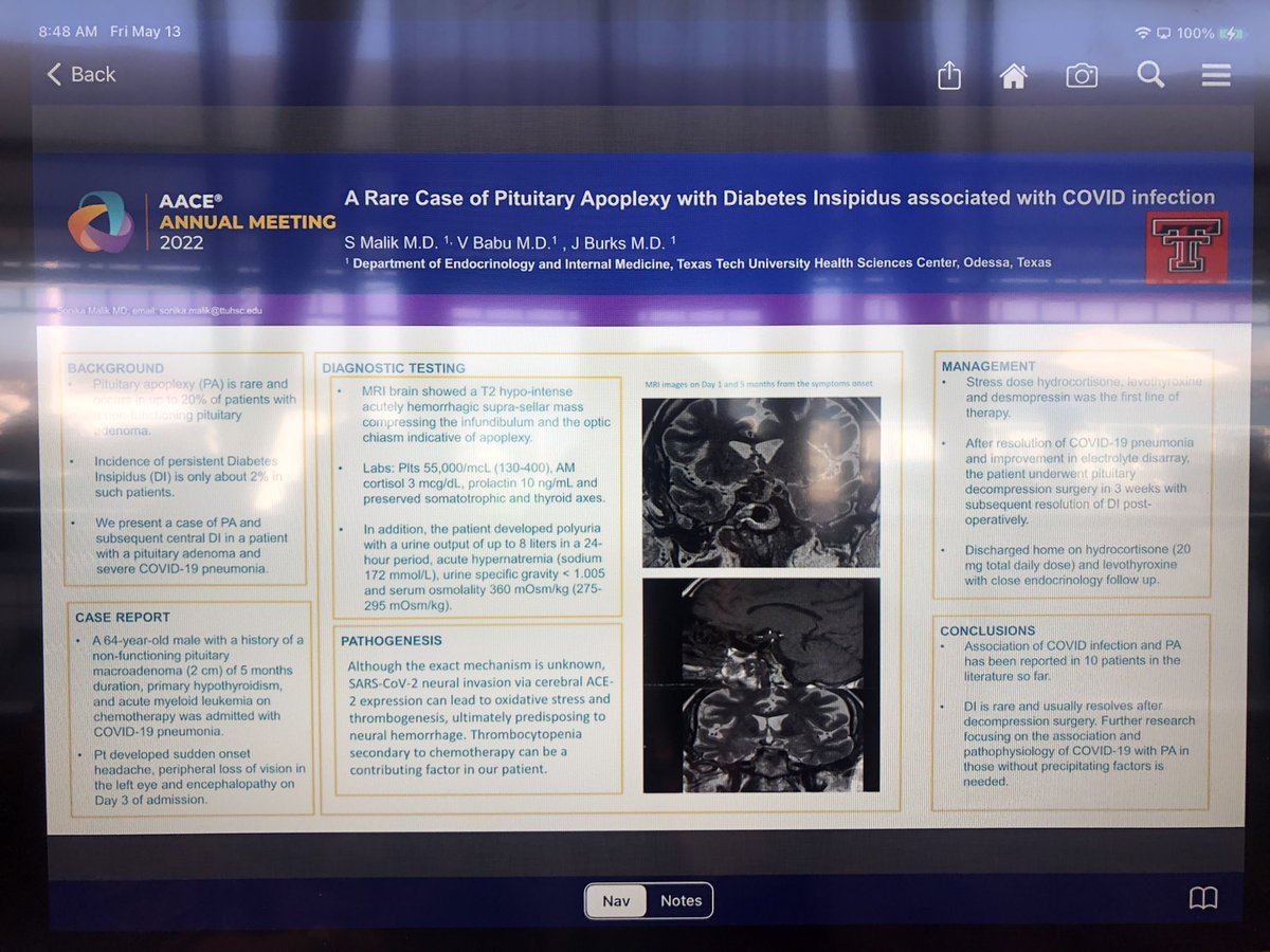EndoGrinBoy's tweet photo. Come see my posters😄@TheAACE #AACE2022 @TTechPBIMRes Represent! https://t.co/ebeKA0fWz8