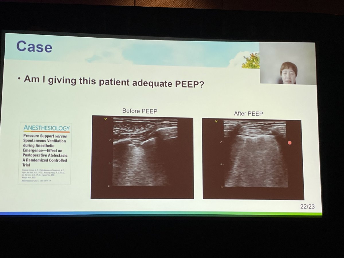 EmilyTeeterMD's tweet photo. Excellent talk on lung ultrasound by Dr. Hyun Joo Ahn, delivered virtually from South Korea. π« π #SCATAS2022 @scahq_tas @scahq https://t.co/fUTcl1fGSS