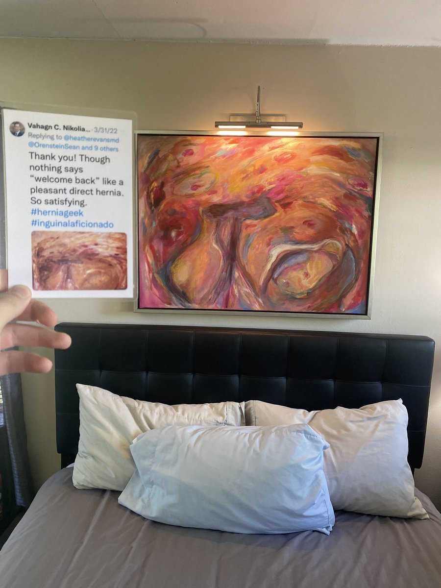Steven Cochrun (@cochrunsl) on Twitter photo I don’t know about y’all, but this is one of the best birthday presents ever! My partner does commissions for anyone curious 👀 Thanks <a href="/VNikolian/">Vahagn C. Nikolian, MD</a> for inspiration #hernia <a href="/abhishekpar/">Abhishek Parmar</a> @britneycoreymd <a href="/UABSurgery/">UAB Surgery</a> <a href="/UABGISurgery/">UAB GI Surgery</a> I don’t know about y’all, but this is one of the best birthday presents ever! My partner does commissions for anyone curious 👀 Thanks <a href="/VNikolian/">Vahagn C. Nikolian, MD</a> for inspiration #hernia <a href="/abhishekpar/">Abhishek Parmar</a> @britneycoreymd <a href="/UABSurgery/">UAB Surgery</a> <a href="/UABGISurgery/">UAB GI Surgery</a>