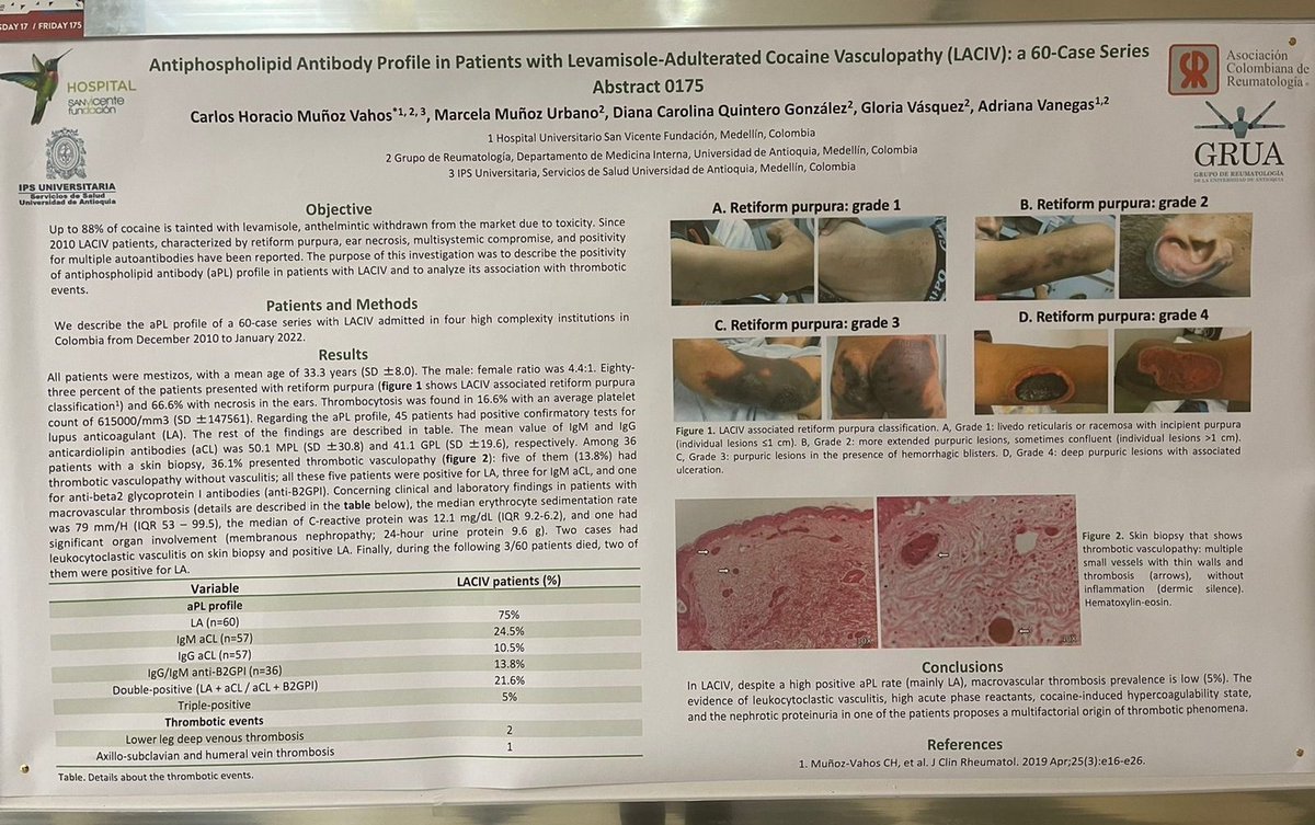 arbelaez_cortes's tweet photo. Gran trabajo! Felicitaciones al equipo de GRUA @Medicina_UdeA y @sanvicentefund. Gracias por compartir experiencias académicas. @Asoreuma @svareuma @doctoravanegas @doctorchmunoz @glomavas @marcemu_02 https://t.co/5czSo59GcE