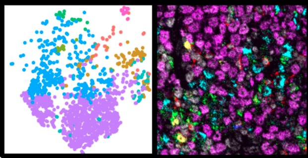 Indica_Labs's tweet photo. Register today for our June 9 webinar to learn about an open-source MIBI image analysis pipeline and how to validate a #multiplexIF panel for deployment in a clinical setting!
https://t.co/vFWKui8i9m
#pathtwitter #digitalpathology #imagingmasscytometry #immunooncology https://t.co/1DBlzyZeOg