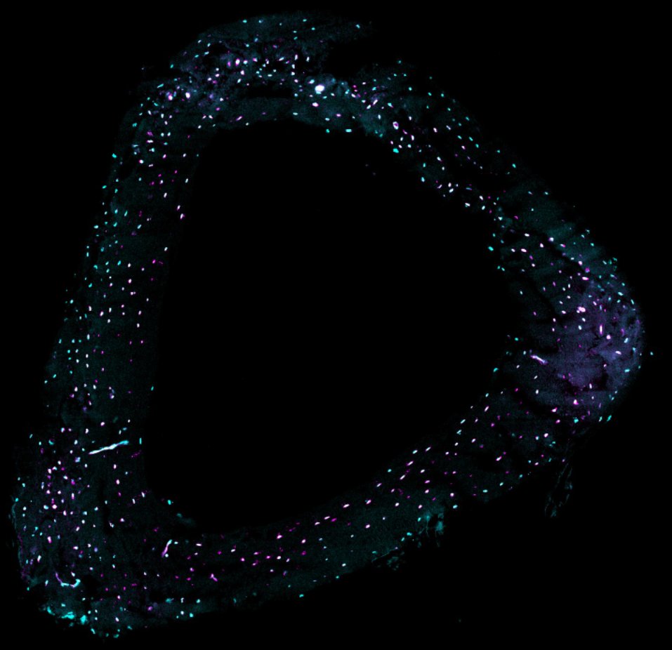 Institute for Chemical Imaging of Living Systems (@cilsinstitute) on Twitter photo Image of the Week: HCR FISH in mouse bone cryosection imaged via <a href="/zeiss_micro/">ZEISS Microscopy</a> LSM 800 confocal
#FluorescenceFriday #Imaging #Microscopy
Credit: <a href="/meslier_q/">Quentin Meslier</a> / Shefelbine Lab, Northeastern MIE <a href="/NUBioE1/">Northeastern University Bioengineering</a> <a href="/NortheasternCOE/">Northeastern COE</a> Image of the Week: HCR FISH in mouse bone cryosection imaged via <a href="/zeiss_micro/">ZEISS Microscopy</a> LSM 800 confocal
#FluorescenceFriday #Imaging #Microscopy
Credit: <a href="/meslier_q/">Quentin Meslier</a> / Shefelbine Lab, Northeastern MIE <a href="/NUBioE1/">Northeastern University Bioengineering</a> <a href="/NortheasternCOE/">Northeastern COE</a>