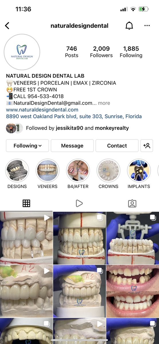 IvanPizzoni's tweet photo. follow my dental ig @naturaldesigndental https://t.co/LQfol08hHN
