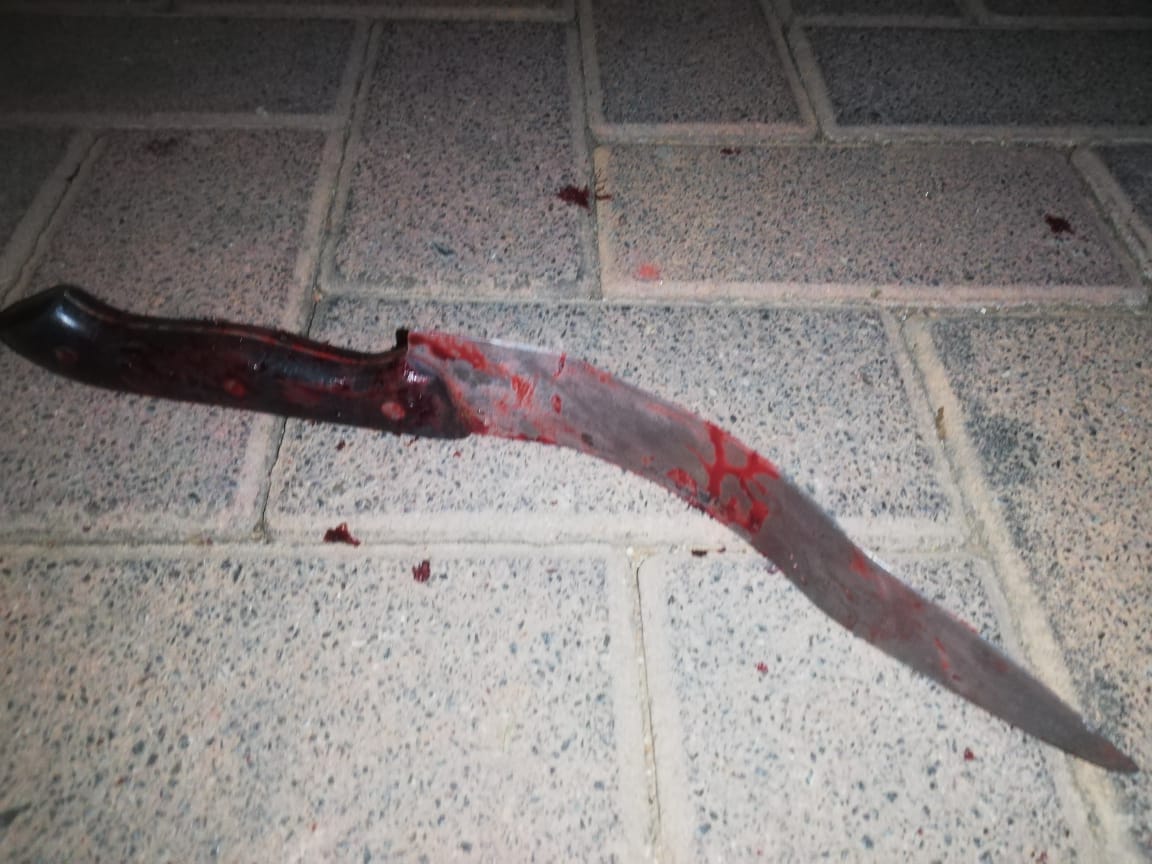 MadikizelaThado's tweet photo. Friday the 13th I was punched and butchered by an abuser angaka khohlwa skgama!!!! https://t.co/D9UcinlI7u