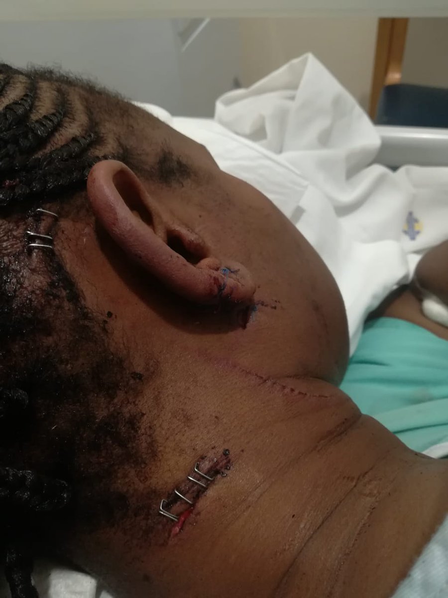 MadikizelaThado's tweet photo. Friday the 13th I was punched and butchered by an abuser angaka khohlwa skgama!!!! https://t.co/D9UcinlI7u
