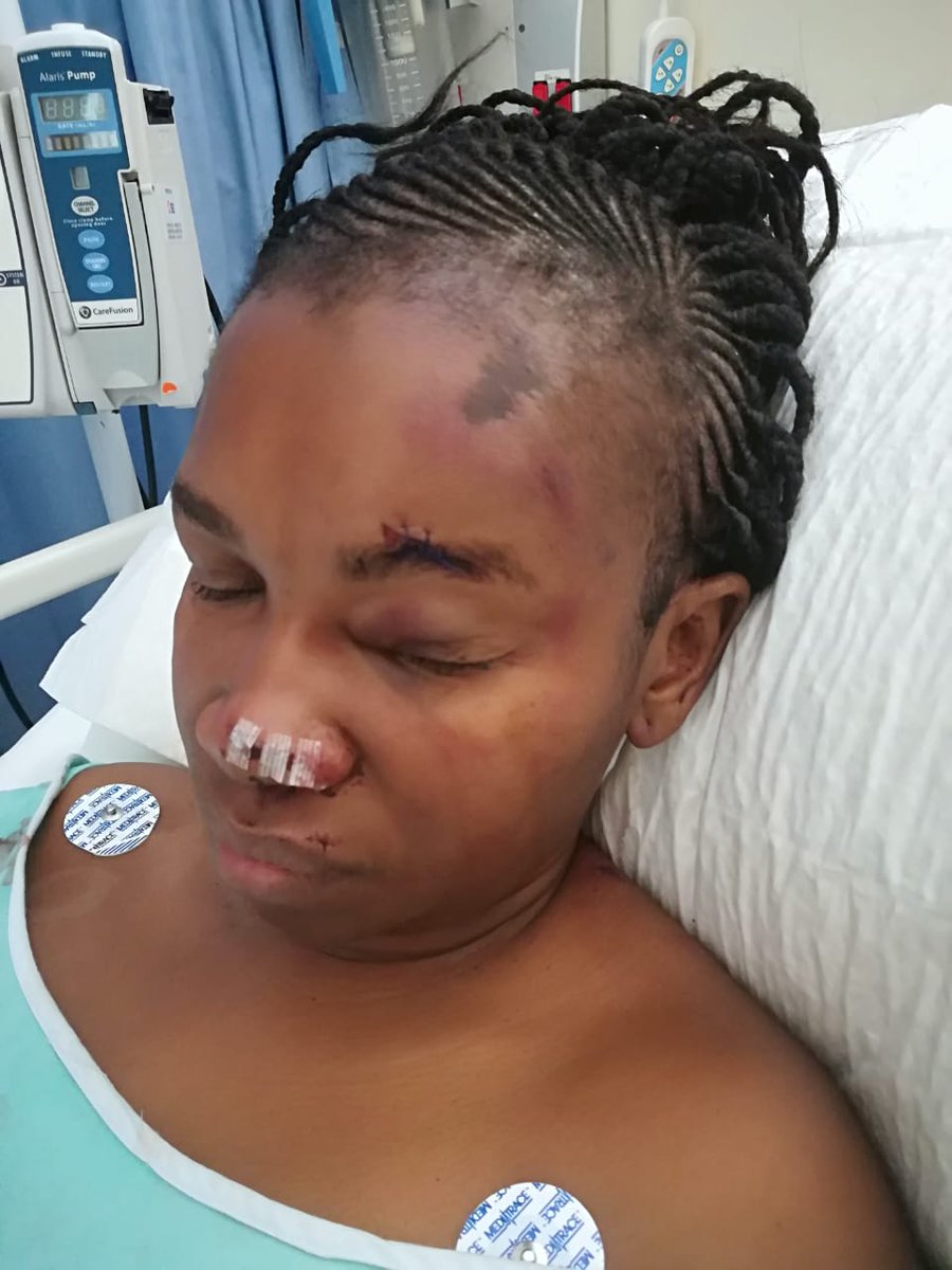 Friday the 13th I was punched and butchered by an abuser angaka khohlwa skgama!!!!