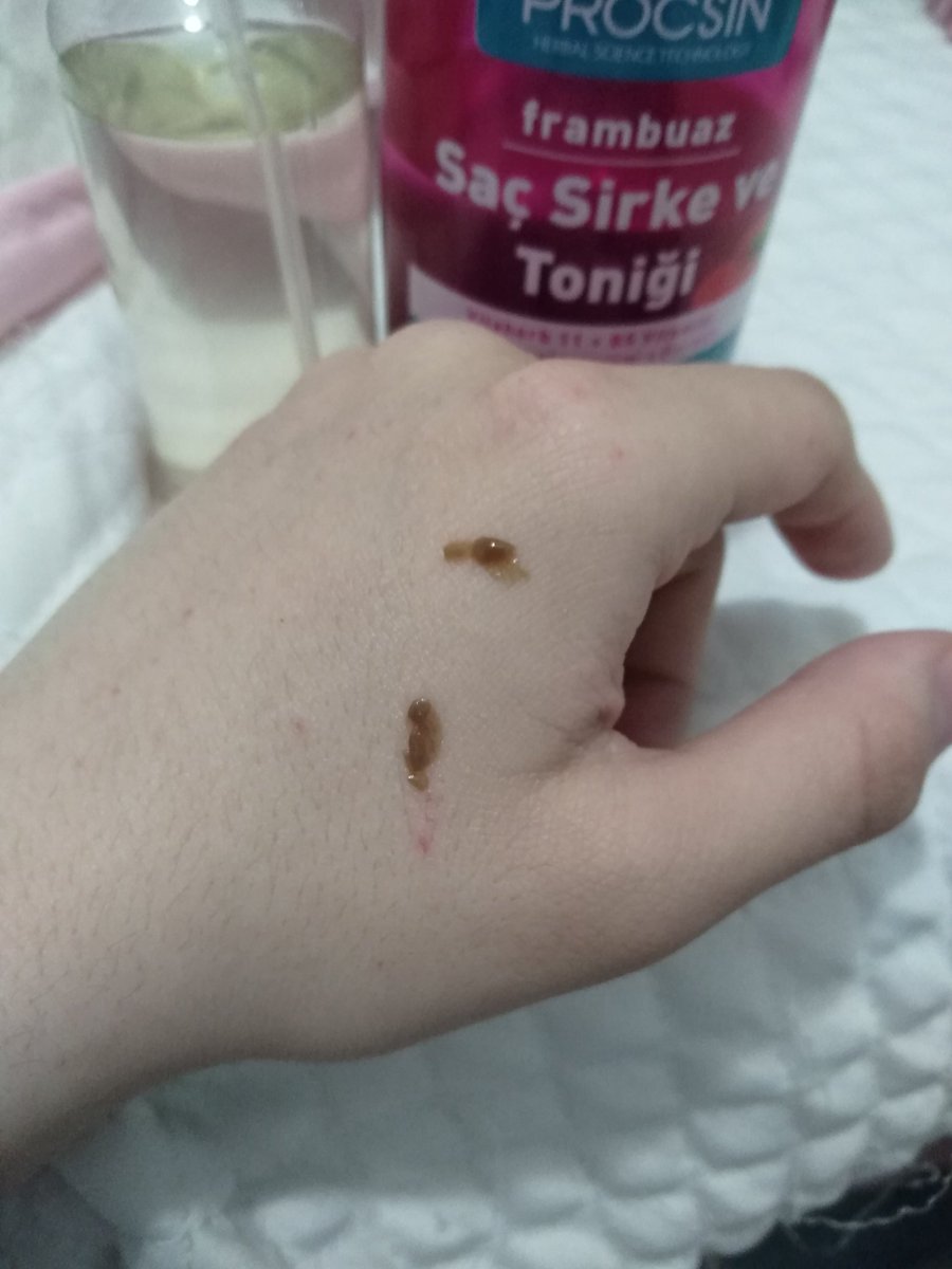 monayoru's tweet photo. Procsin saç sirke ve toniğini kolay uygulamak için sprey şişeye boşaltırken içinden bunlar çıktı? #procsin https://t.co/2gI8Gs5u89