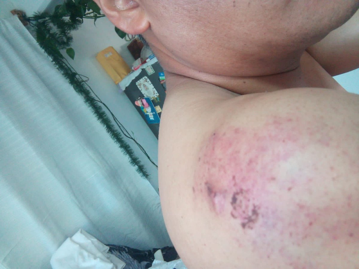 OvsietePlus's tweet photo. Sales a correr y terminas en el hospital con un fuerte golpe en el hombro https://t.co/u2lShRIBwW