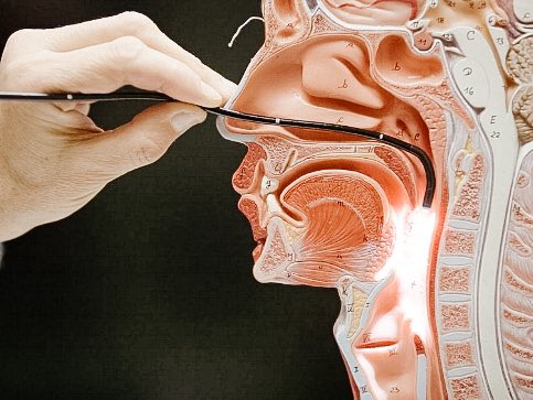 Samgp4's tweet photo. We use a video scope to get an inside look of the voice and swallow in action. The scope is passed through one side of the nose and rests just behind the uvula  to get a bird’s eye view of the anatomy of the throat (same route as a COVID swab but much less painful) @speechhearbc https://t.co/grjwuSOAou