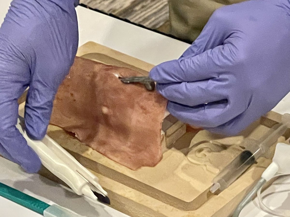 LKolarczyk_MD's tweet photo. Critical Procedures Workshop #1 at #SCATAS2022! Lots of hands on experience with Dr. @AirwayOnDemand at the cricothyrotomy station. More pictures to follow! @scahq https://t.co/5OJAahU9GK