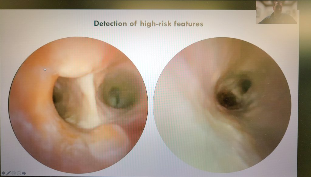 Transcatheter Neurosurgical Technologies Lab tweet media