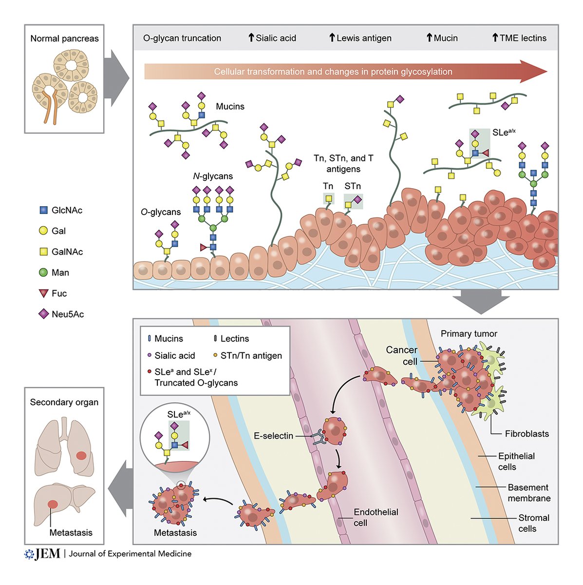 Journal of Experimental Medicine (@jexpmed) on Twitter photo Altered glycosylation in #PancreaticCancer and beyond. A new #CancerFocus Review from <a href="/J_Lumibao/">Jan Lumibao</a>, <a href="/JacobRTremblay/">Jake Tremblay</a>, Hsu and <a href="/DannieEngle/">Dr. Dannie</a> <a href="/EngleLabSalk/">Engle Lab</a> <a href="/salkinstitute/">Salk Institute</a>: bit.ly/3kN5EFu
#SolidTumors Altered glycosylation in #PancreaticCancer and beyond. A new #CancerFocus Review from <a href="/J_Lumibao/">Jan Lumibao</a>, <a href="/JacobRTremblay/">Jake Tremblay</a>, Hsu and <a href="/DannieEngle/">Dr. Dannie</a> <a href="/EngleLabSalk/">Engle Lab</a> <a href="/salkinstitute/">Salk Institute</a>: bit.ly/3kN5EFu
#SolidTumors