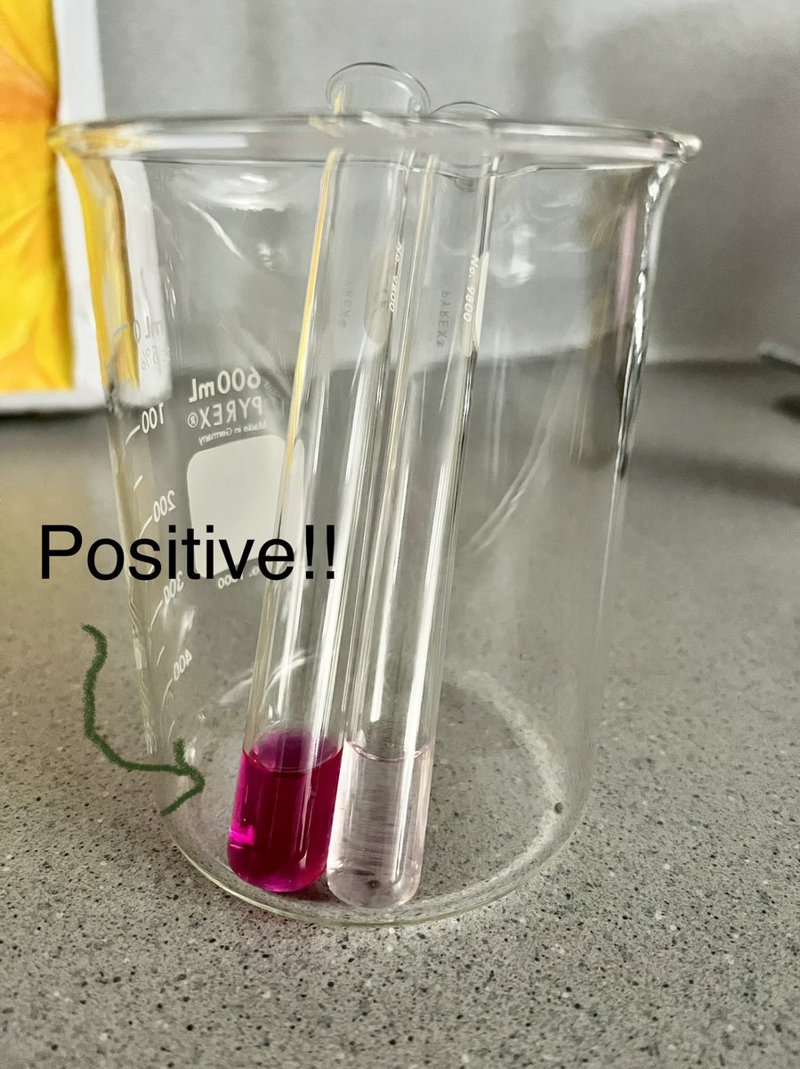 zhenbio's tweet photo. Will you be infected?? 😷
Real-life simulation of how fast viruses travel. 🦠 If you are tested positive, you need to be quarantined! 🏥 
#TodayatWHS #zhenbio https://t.co/WbqC5S6DRc