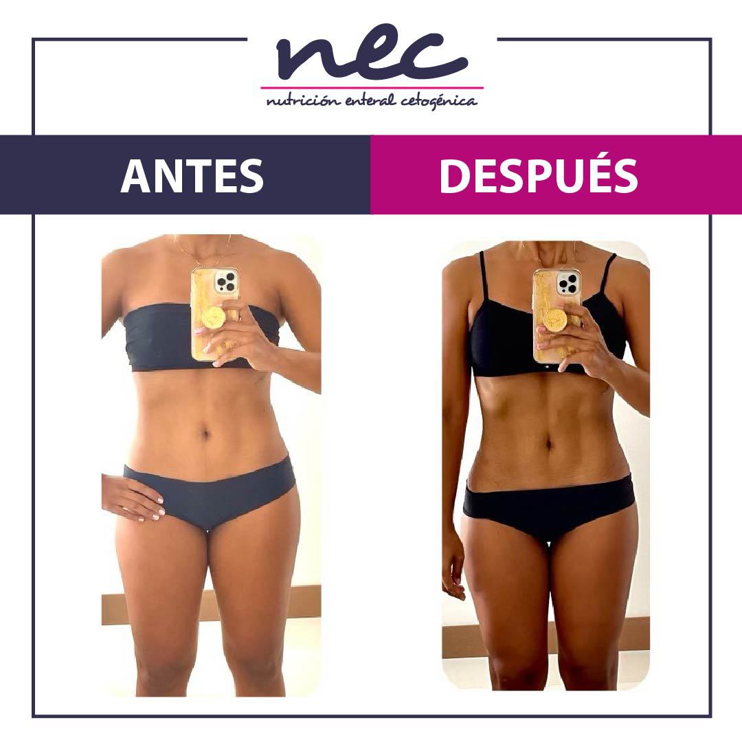 MetodoNec's tweet photo. Nuestra paciente nos compartió los resultados luego de los 10 días con Método NEC. Si deseas más información,  déjanos tus datos en https://t.co/LRC2M1Apmm

#métodonec #bajardepeso #bajardepesorapido #proteinas #estilodevidasaludable #adelgazar #keto #ketodieta #cetogenica https://t.co/naZD3mGCbx