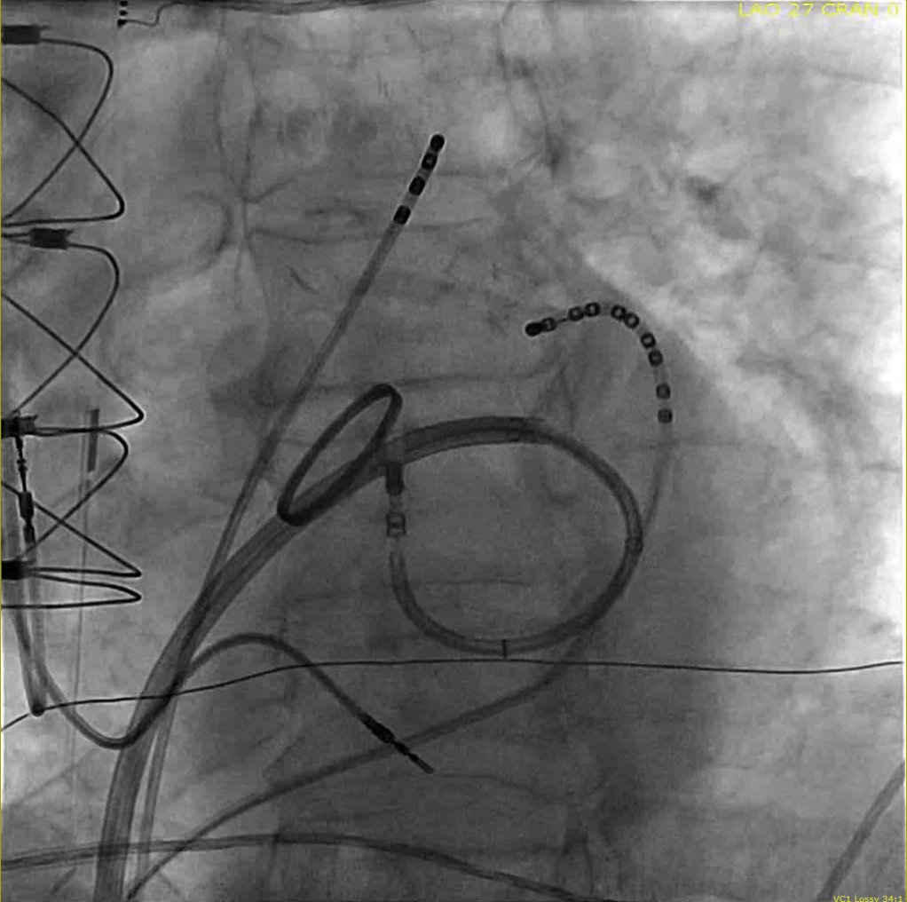 Madhu Reddy tweet media