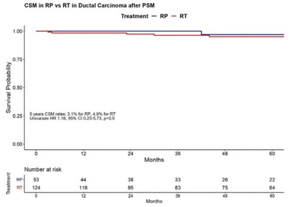 Survival after radical prostatectomy vs radiation therapy in ductal carcinoma of the prostate. Presentation by @FChierigo. #AUA22 written coverage by <a href="/zklaassen_md/">Zach Klaassen</a> <a href="/GACancerCenter/">Georgia Cancer Center</a> on UroToday &gt; bit.ly/3sD9XYj <a href="/AmerUrological/">Amer. Urol. Assn.</a>