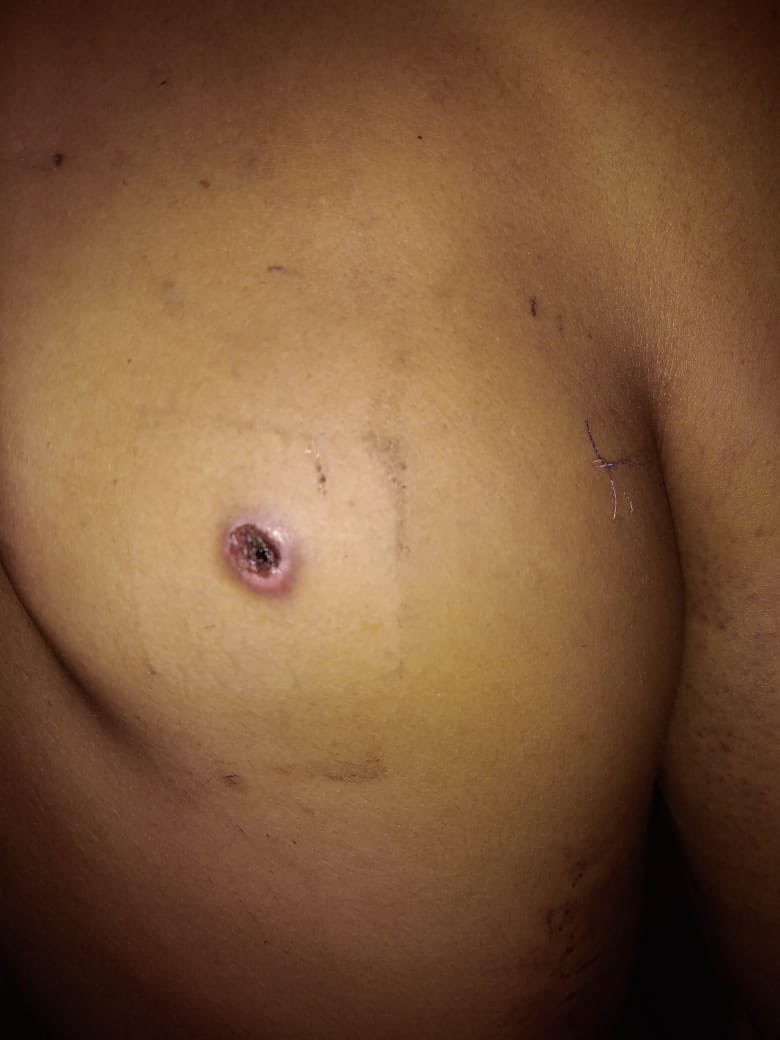 #DENUNCIA Están intentando asesinar a los ex-farc que si pagaron condena y que están aportando con la verdad para la ubicación de las fosas de los asesinados y desaparecidos por las #FARC. Hacen lo que los senadores farc no hacen y ahora los intentan callar. Recibió tres disparos