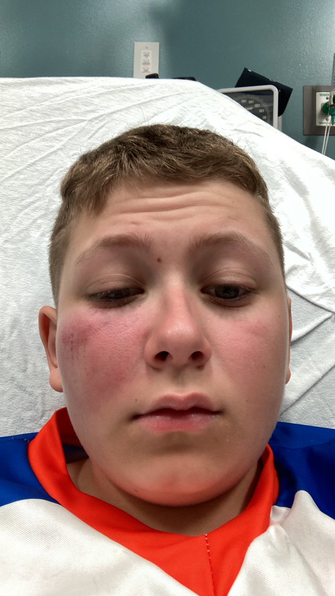 Tyler Stratton (@t_strats14) on Twitter photo Fastball to eyeballโฆ worth the win though. Thanks <a href="/TannerLudwig7/">Tanner Ludwig</a> for running the bases Fastball to eyeballโฆ worth the win though. Thanks <a href="/TannerLudwig7/">Tanner Ludwig</a> for running the bases