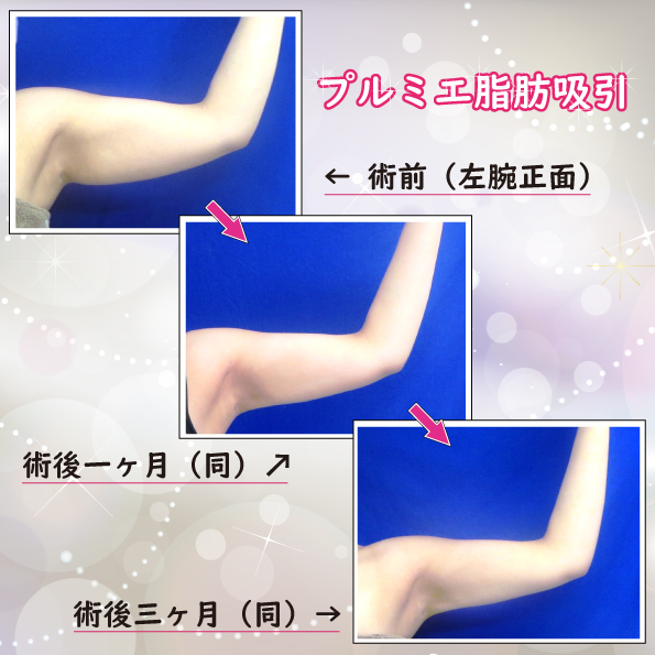 広島プルミエクリニック 公式 Premier1clinic Twitter