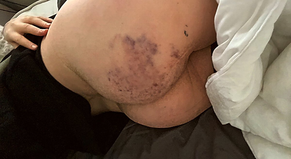 delicate_eff13's tweet photo. cover me in bruises baby x #nsfw https://t.co/iJkooLAH2p