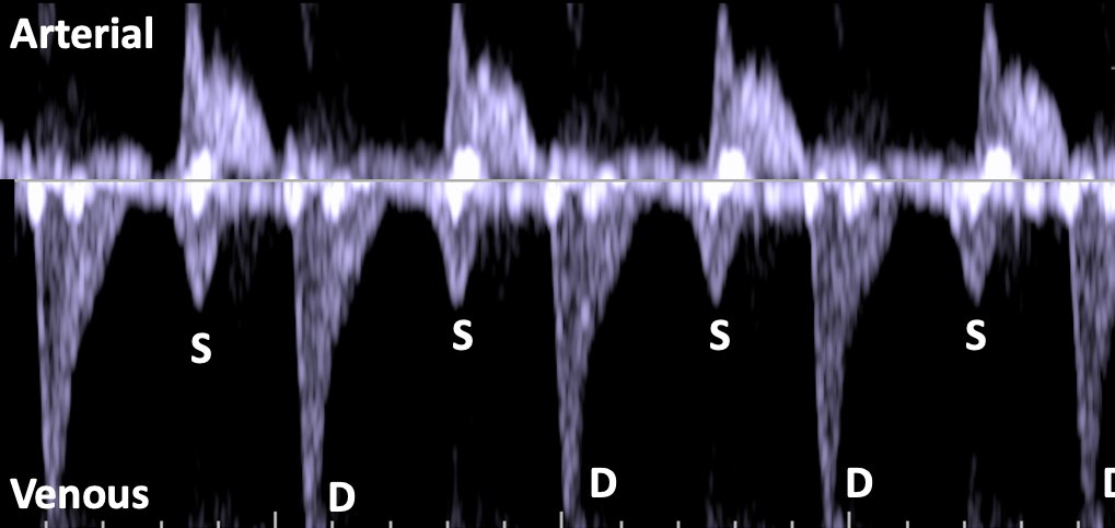 Where is this Doppler Waveform from? and, What can it tell us about ...