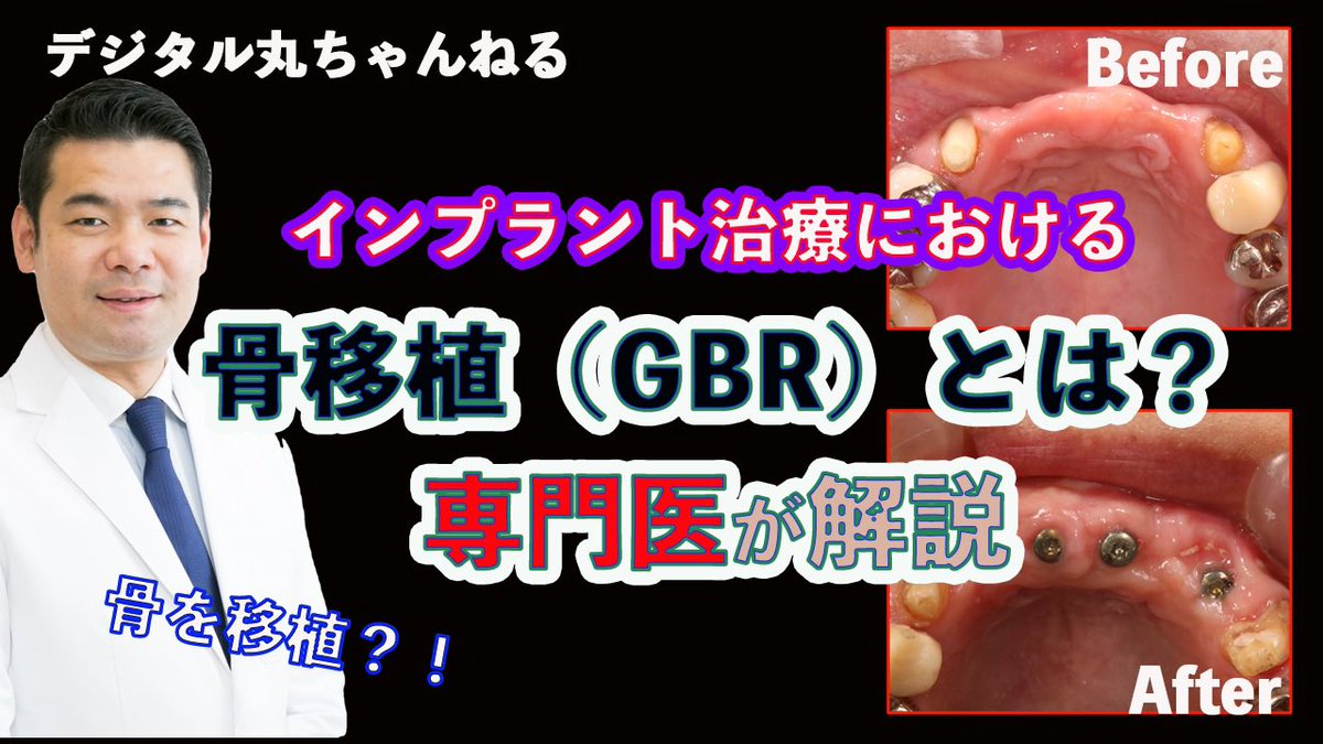 dr_maruo_'s tweet photo. YouTube【デジタル丸ちゃんねる】ランキング第4位！
https://t.co/lxLJfLrsNk https://t.co/9ry1AJyRDf