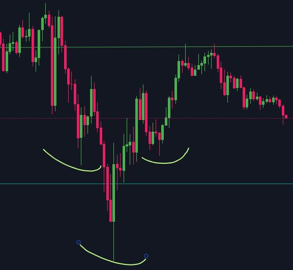 diamantscrypto's tweet photo. @BitcoinHypers bro,yestrday we had nice h&amp;s, and then sfp :/ https://t.co/9IrYe8oYt9