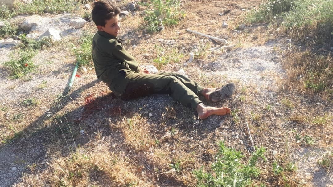 🔴 Böyle Vahşet Görülmedi ❗
Suriye'nin kuzeyinde ki tekfirci teröristler, Halep kırsalında şehid olan Suriye Askerlerinin cenaze merasimi sırasında roketatarlarla saldırması sonucu Çok sayıda sivil ve çocuk yaralanırken, 1 çocuk da şehid oldu.
#نبل_والزهراء