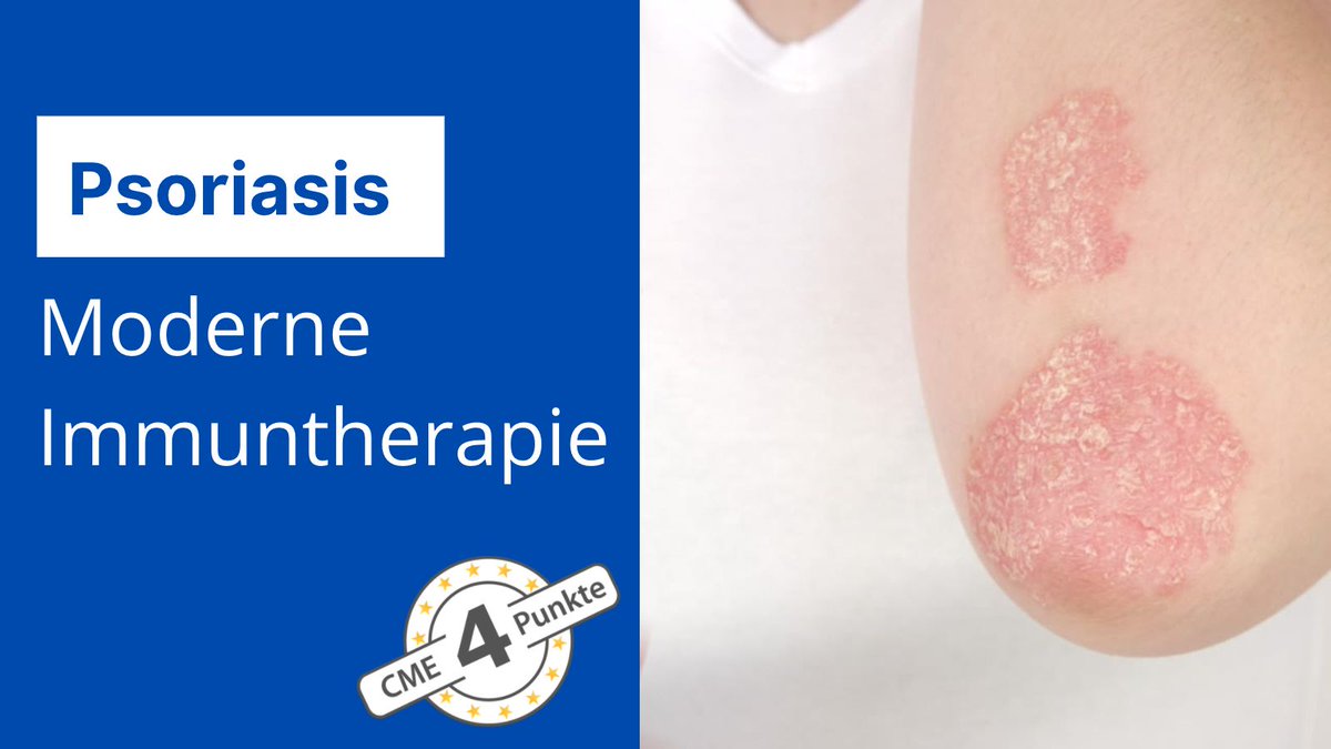 Moderne Immuntherapie der Psoriasis. Unsere neue Fortbildung mit 4 #CME Punkten. Jetzt loslegen!

bit.ly/PsoriasisCME
#psoriasis #fortbildung #Health