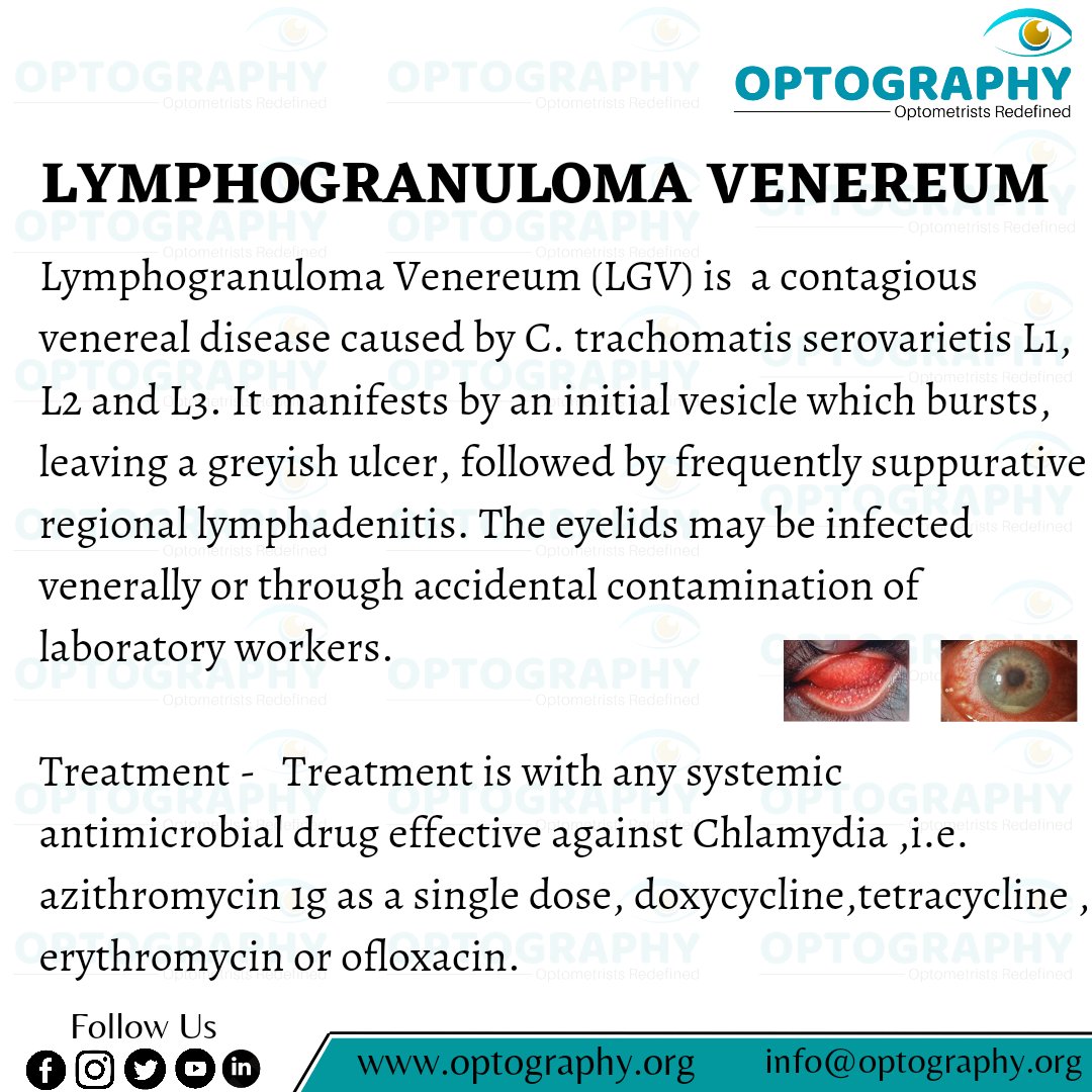 Lymphogranuloma Venereum