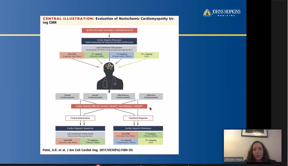 Antony Anandaraj (@antanee) on Twitter photo Happening now! Imaging evaluation of ARVC & Infiltrative cardiomyopathies by Dr. Hays
<a href="/AllisonGHaysMD/">Allison G. Hays, MD</a>
#ACCEarlyCareer #IowaACCLectures
<a href="/ACCinTouch/">American College of Cardiology</a>
<a href="/SCMRorg/">Society for Cardiovascular Magnetic Resonance</a>
<a href="/Heart_SCCT/">Heart_SCCT</a> Happening now! Imaging evaluation of ARVC & Infiltrative cardiomyopathies by Dr. Hays
<a href="/AllisonGHaysMD/">Allison G. Hays, MD</a>
#ACCEarlyCareer #IowaACCLectures
<a href="/ACCinTouch/">American College of Cardiology</a>
<a href="/SCMRorg/">Society for Cardiovascular Magnetic Resonance</a>
<a href="/Heart_SCCT/">Heart_SCCT</a>