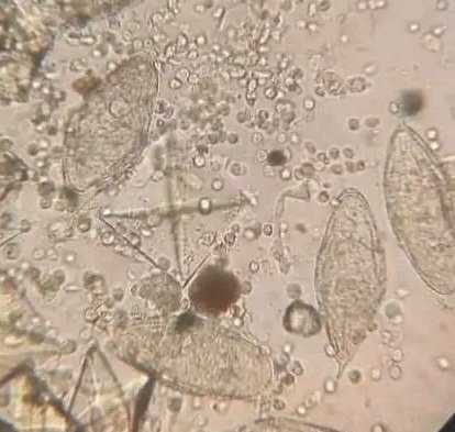 abualbaraSH's tweet photo. #urine_analysis
يوجد في الصورة 5 اشياء فما هي ؟!
1.....
2.....
3.....
4.....
5.....
ملاحظة : الصورة ليست لي https://t.co/FFtoSmYzef