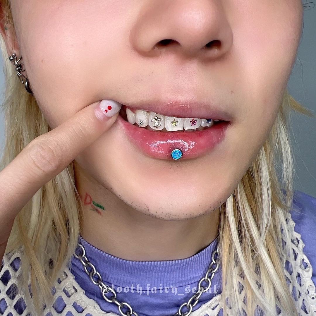 baby blue braces colors