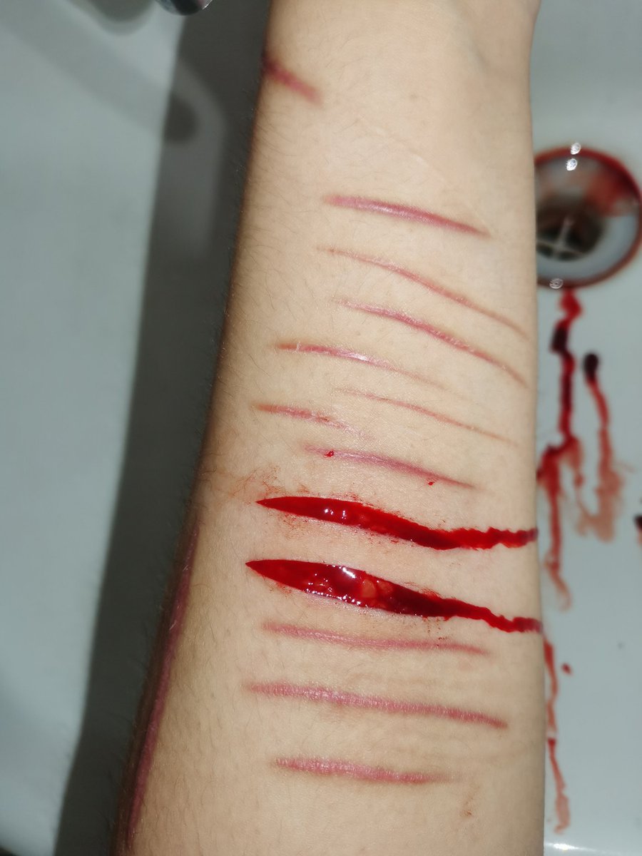 SOLITARYCORPSE's tweet photo. 5.14
左小臂。 https://t.co/X0FqvYNwod