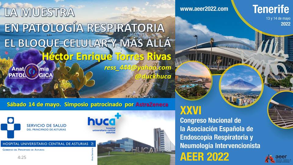 duckhuca's tweet photo. @AeerNeumologia @HUCA_Asturias https://t.co/LXiXfs2srE